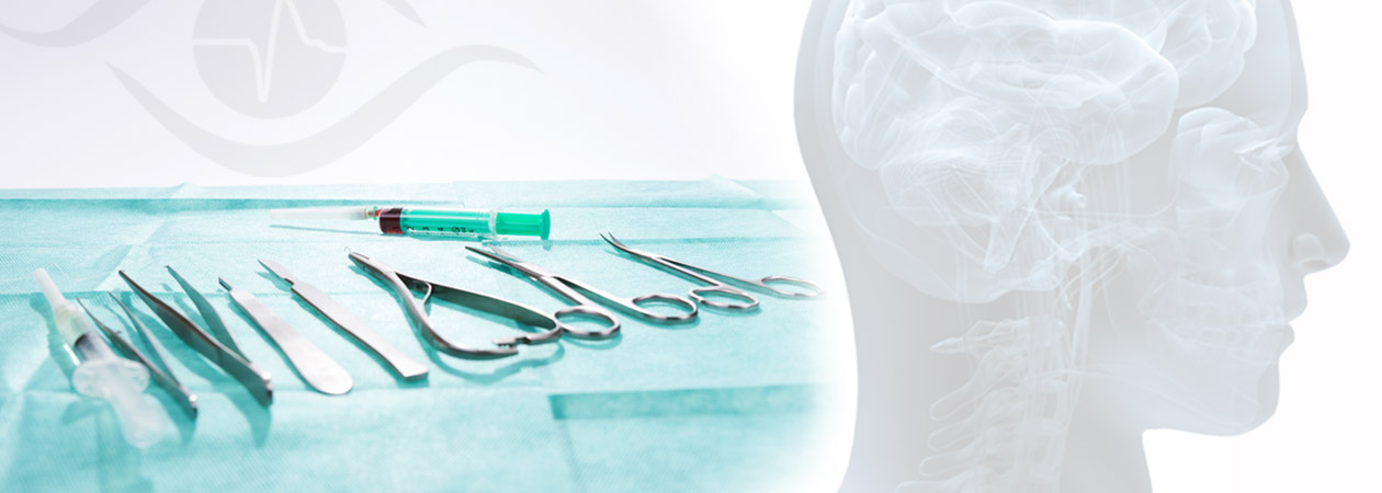 Vascular surgery